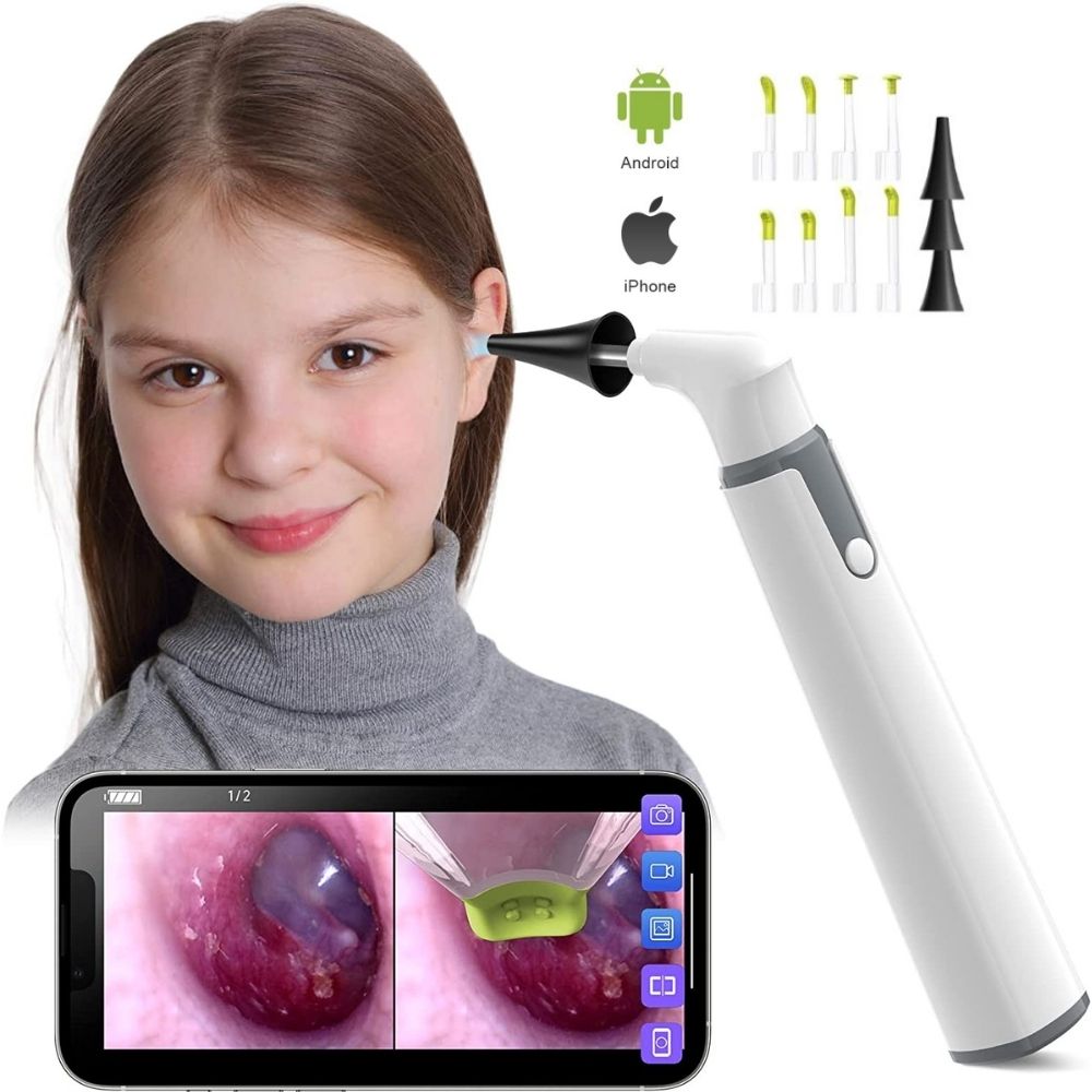 Veterinary Otoscope - WIFI Digital Otoscope Ear Camera 3.9mm