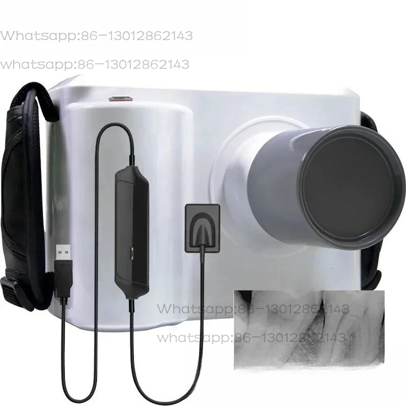 Full Set Portable Dental X ray - Veterinary X Ray Machine 评论和价格