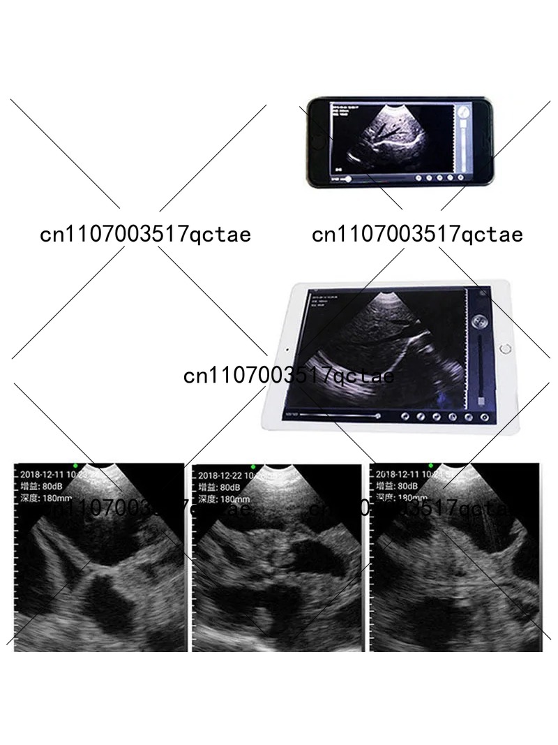 64 Element Wireless Veterinary - Livestock Ultrasound Pregnancy 评论和价格