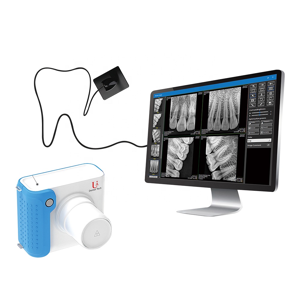 Photon-Counting Dental-Veterin - Veterinary X Ray Machine 评论和价格