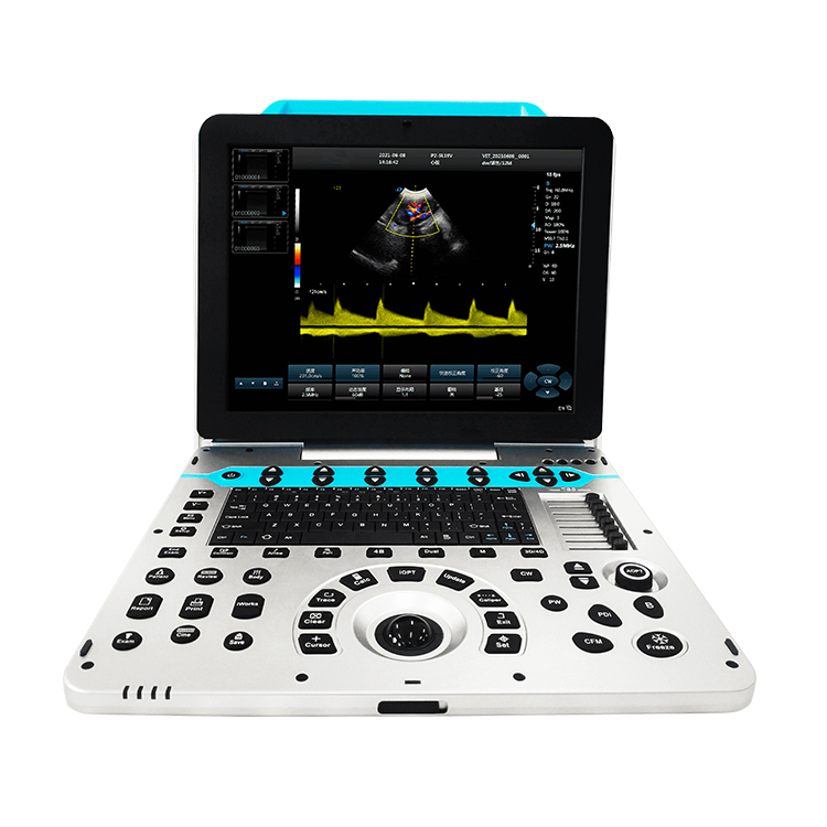 VUP5 Portable Vet Scanner 4D V - Veterinary Ultrasound Scanner Portable 评论和价格