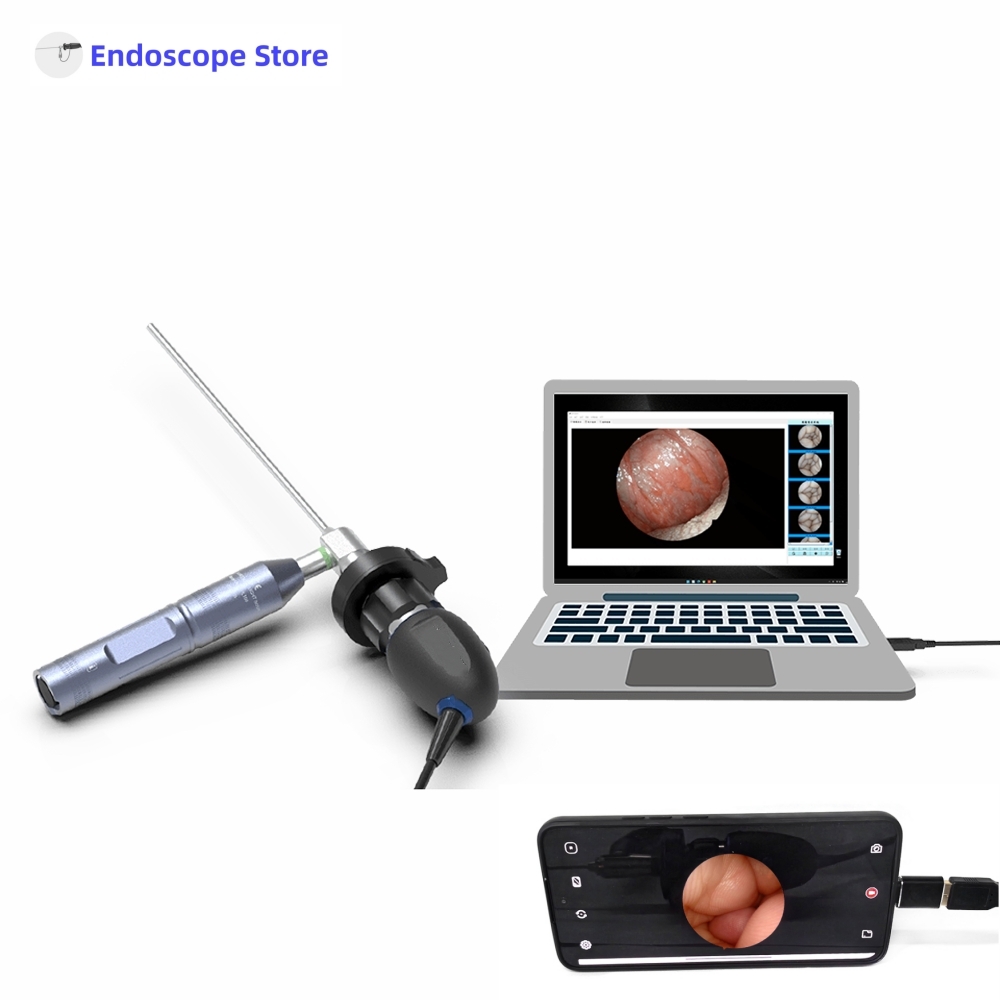 HD 1080P 60FPS Portable Endosc - Veterinary Otoscope 评论和价格