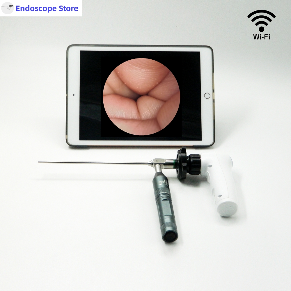 HD 1080P 60FPS Portable Endosc - Veterinary Otoscope 评论和价格