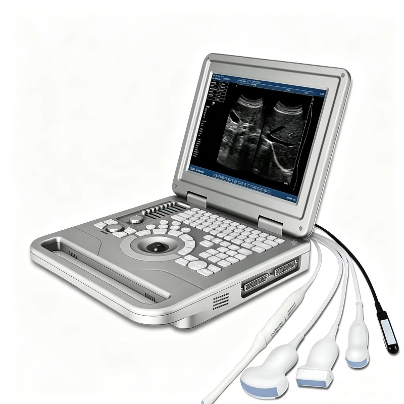 Portable Veterinary Ultrasound - Veterinary Ultrasound Scanner Portable 评论和价格