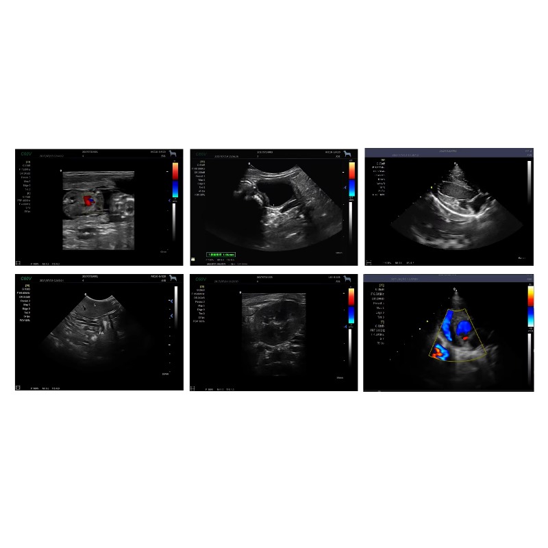 Portable Veterinary Ultrasound - Veterinary Ultrasound Scanner Portable 评论和价格