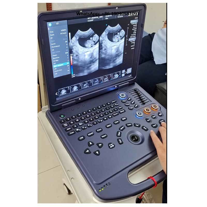 Dawei Portable Ultrasound Vete - Veterinary Ultrasound Scanner Portable 评论和价格