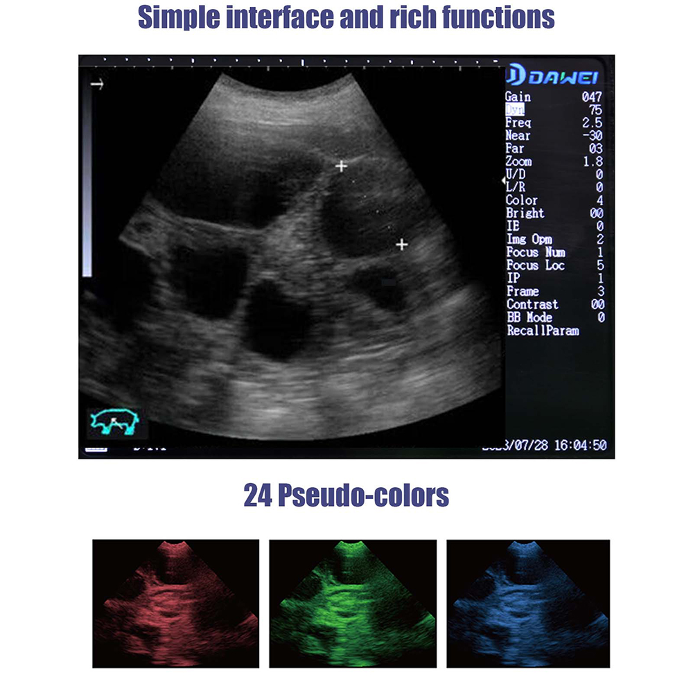 Portable Veterinary Ultrasound - Veterinary Ultrasound Scanner Portable 评论和价格