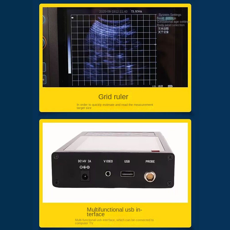 5.6 Inch Portable Veterinary U - Livestock Ultrasound Pregnancy 评论和价格