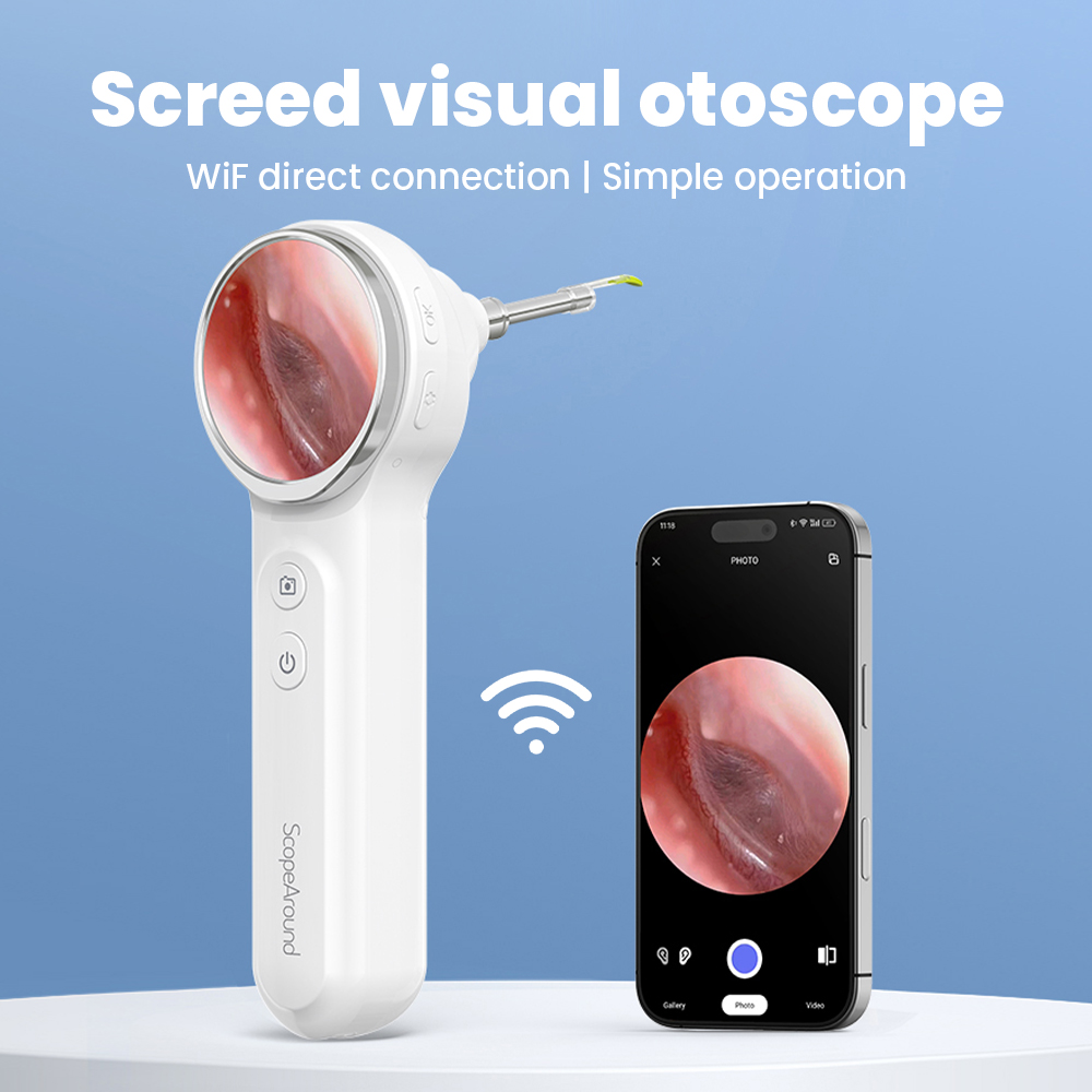 Veterinary Equipment Otoscope  - Veterinary Otoscope 评论和价格