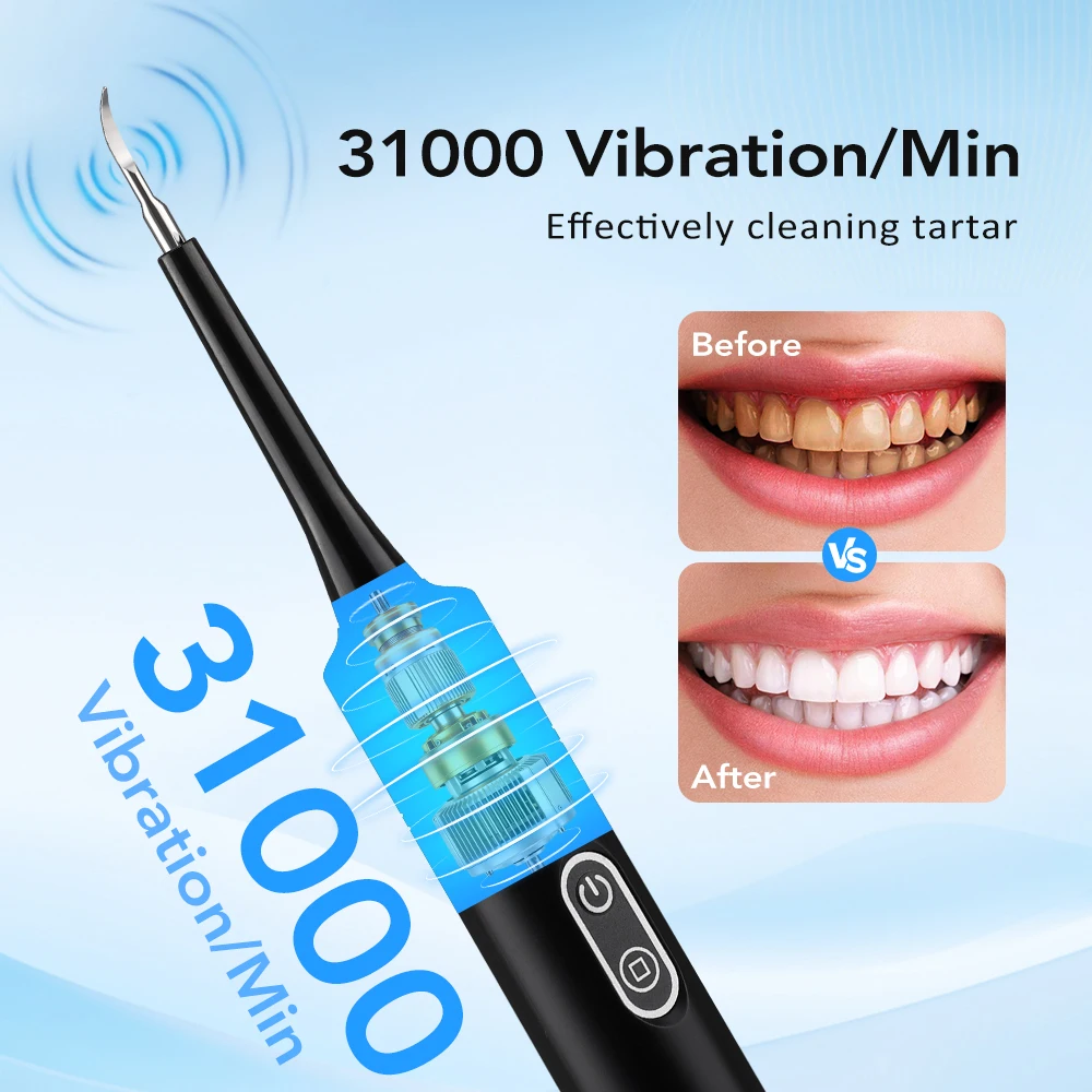 Electric Sonic Vibration Denta - Veterinary Dental Scaler 评论和价格